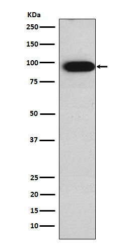 Anti-Villin Rabbit Monoclonal Antibody