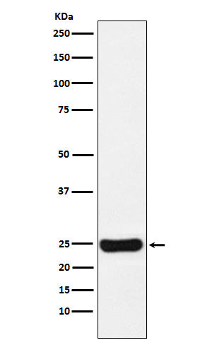 Anti-Cathepsin S Rabbit Monoclonal Antibody