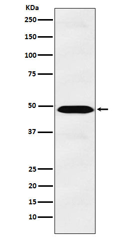 Anti-IL-13 Receptor alpha 1 Rabbit Monoclonal Antibody