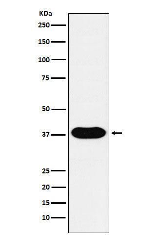 Anti-CD79b Rabbit Monoclonal Antibody