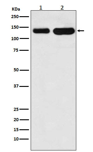 Anti-K Cadherin Rabbit Monoclonal Antibody
