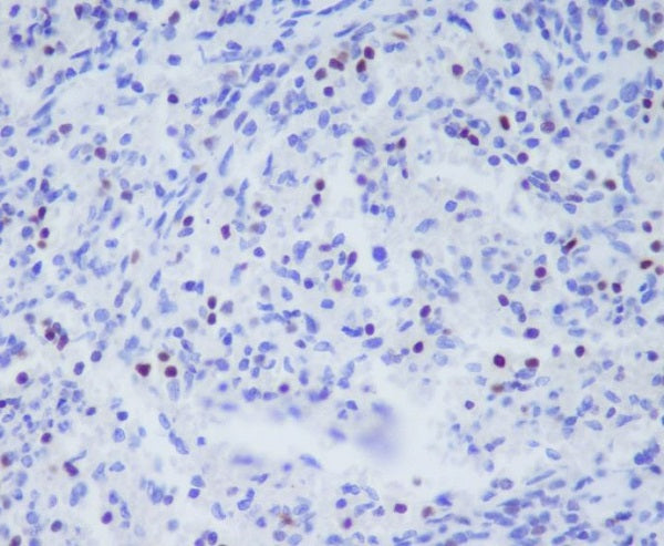 Anti-T Box Protein 21 Rabbit Monoclonal Antibody