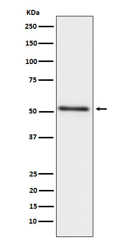 Anti-Prostatic Acid Phosphatase Rabbit Monoclonal Antibody