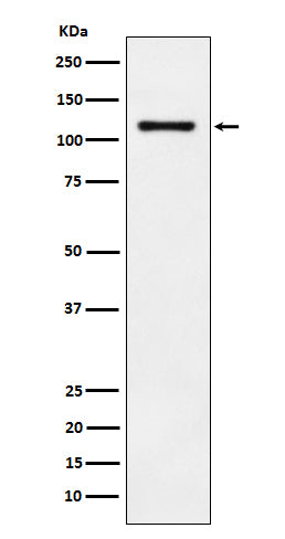 Anti-LI Cadherin Rabbit Monoclonal Antibody