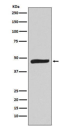 Anti-MAPKAP Kinase 2 Rabbit Monoclonal Antibody