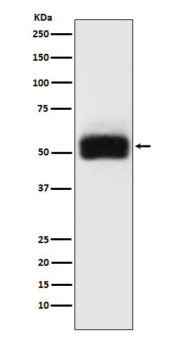 Anti-MMP17 Rabbit Monoclonal Antibody
