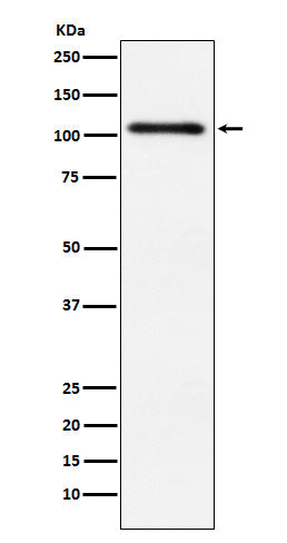 Anti-PKD2 Rabbit Monoclonal Antibody