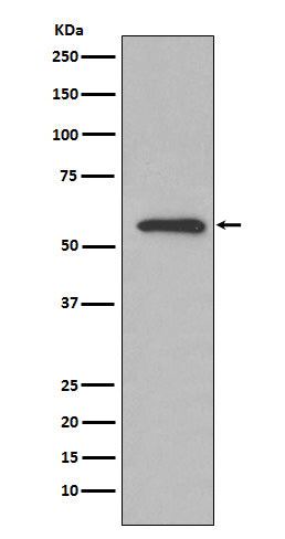 Anti-AMF Rabbit Monoclonal Antibody