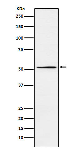 Anti-MEIS2 Rabbit Monoclonal Antibody