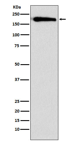 Anti-SMARCC1 Rabbit Monoclonal Antibody