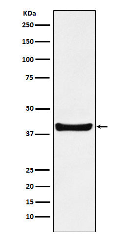 Anti-p40 Rabbit Monoclonal Antibody