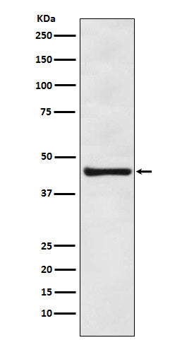 Anti-eIF4A3 Rabbit Monoclonal Antibody
