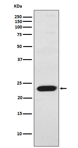 Anti-Troponin I Rabbit Monoclonal Antibody