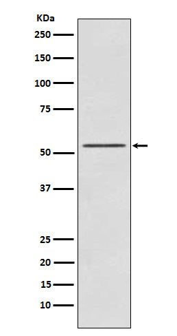 Anti-S6K2 Rabbit Monoclonal Antibody