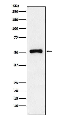 Anti-Retinoic Acid Receptor gamma Rabbit Monoclonal Antibody