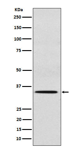 Anti-Sulfotransferase 2A1 Rabbit Monoclonal Antibody