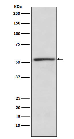 Anti-TBL1XR1 Rabbit Monoclonal Antibody