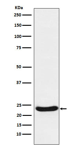 Anti-Complex III Subunit 5 Rabbit Monoclonal Antibody