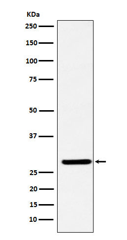 Anti-FHL2 Rabbit Monoclonal Antibody