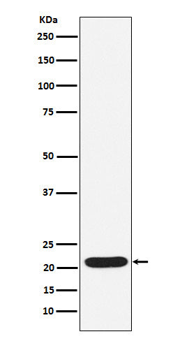 Anti-SOCS2 Rabbit Monoclonal Antibody