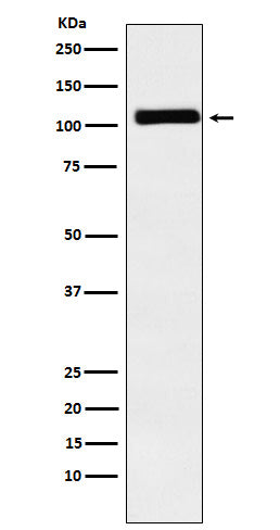 Anti-MIB1 Rabbit Monoclonal Antibody
