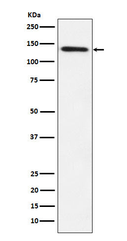 Anti-Lipin 1 Rabbit Monoclonal Antibody