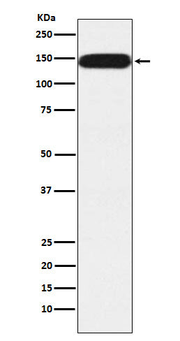 Anti-PUM1 Rabbit Monoclonal Antibody