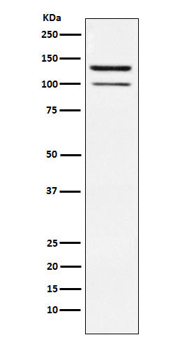 Anti-HIPK2 Rabbit Monoclonal Antibody