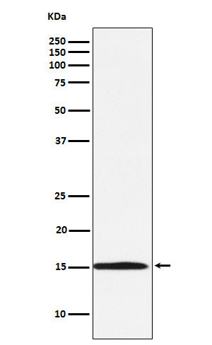 Anti-Ubiquitin Conjugating Enzyme E2 N Rabbit Monoclonal Antibody