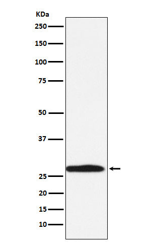 Anti-Carbonic Anhydrase 1 Rabbit Monoclonal Antibody