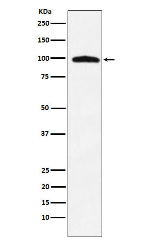 Anti-TNPO3 Rabbit Monoclonal Antibody