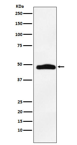 Anti-MAPKAP Kinase 2 Rabbit Monoclonal Antibody