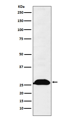 Anti-Human kappa Light Chain Rabbit Monoclonal Antibody