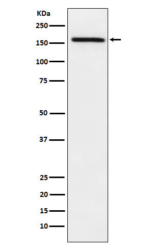 Anti-ADAMTS13 Rabbit Monoclonal Antibody