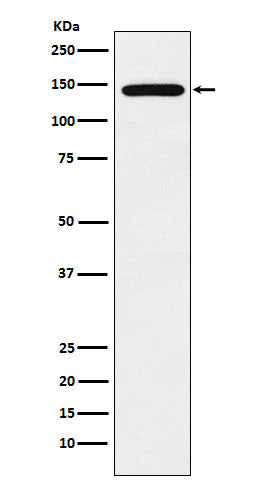 Anti-Protein Jumonji Rabbit Monoclonal Antibody
