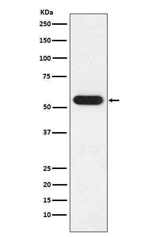 Anti-FKBP52 Rabbit Monoclonal Antibody