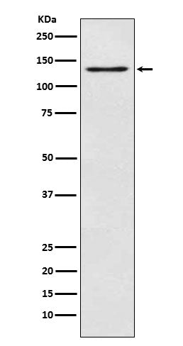 Anti-OGA Rabbit Monoclonal Antibody
