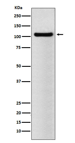 Anti-BRD2 Rabbit Monoclonal Antibody