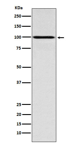 Anti-Interferon gamma Receptor 1 Rabbit Monoclonal Antibody