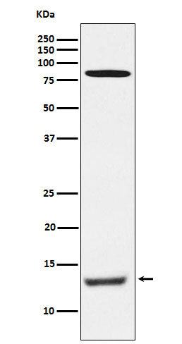 Anti-PEN2 Rabbit Monoclonal Antibody