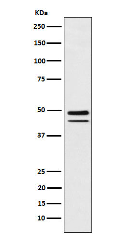 Anti-T Box Transcription Factor T Rabbit Monoclonal Antibody