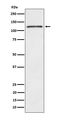 Anti-FYB Rabbit Monoclonal Antibody