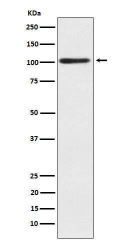 Anti-Sarcomeric alpha Actinin Rabbit Monoclonal Antibody