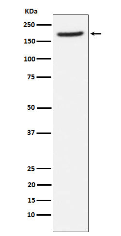 Anti-AP-A Rabbit Monoclonal Antibody
