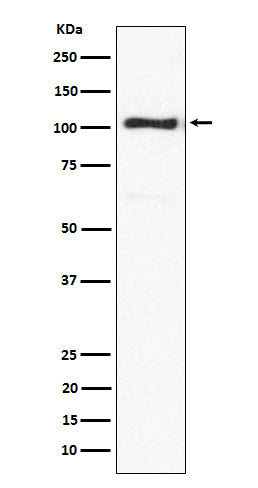 Anti-ACTN3 Rabbit Monoclonal Antibody