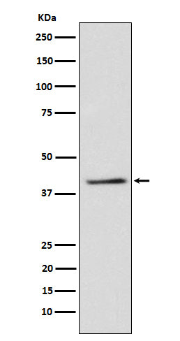 Anti-TRIB3 Rabbit Monoclonal Antibody