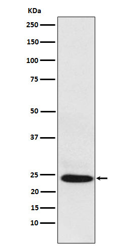 Anti-BAG2 Rabbit Monoclonal Antibody