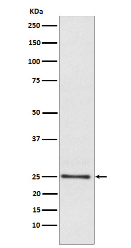 Anti-Lysophospholipase 1 Rabbit Monoclonal Antibody