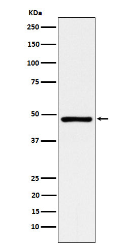 Anti-ACADM Rabbit Monoclonal Antibody