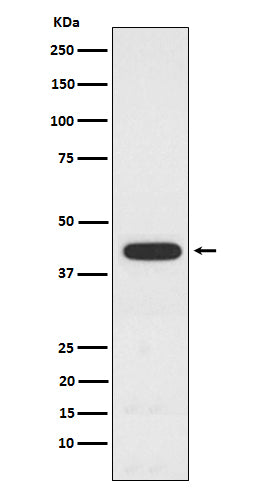 Anti-CT A Rabbit Monoclonal Antibody